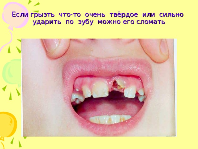 Если грызть что-то очень твёрдое или сильно ударить по зубу можно его сломать 
