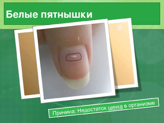 Белые пятнышки