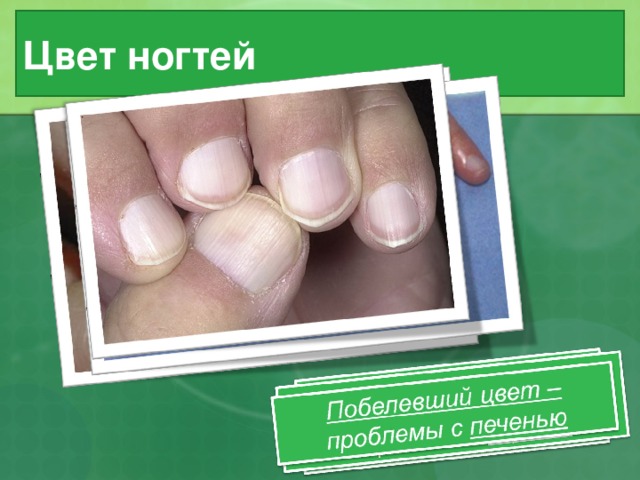 Цвет ногтей