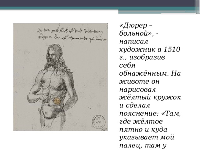 «Дюрер – больной», - написал художник в 1510 г., изобразив себя обнажённым. На животе он нарисовал жёлтый кружок и сделал пояснение: «Там, где жёлтое пятно и куда указывает мой палец, там у меня болит».   