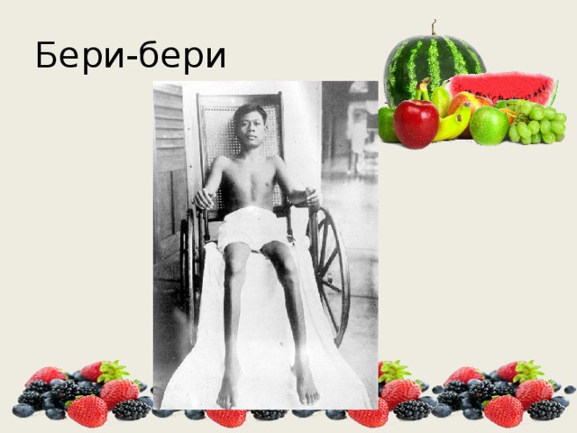Бери-бери 