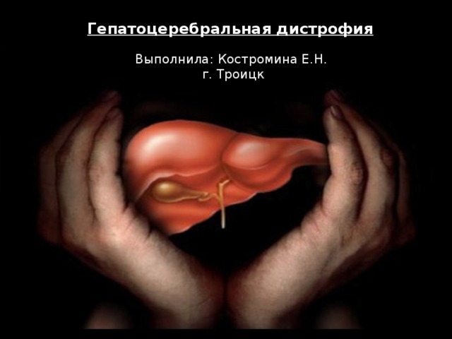Гепатоцеребральная дистрофия Выполнила: Костромина Е.Н. г. Троицк 