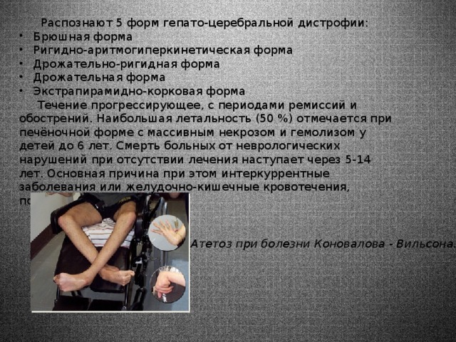  Распознают 5 форм гепато-церебральной дистрофии: Брюшная форма Ригидно-аритмогиперкинетическая форма Дрожательно-ригидная форма Дрожательная форма Экстрапирамидно-корковая форма  Течение прогрессирующее, с периодами ремиссий и обострений. Наибольшая летальность (50 %) отмечается при печёночной форме с массивным некрозом и гемолизом у детей до 6 лет. Смерть больных от неврологических нарушений при отсутствии лечения наступает через 5-14 лет. Основная причина при этом интеркуррентные заболевания или желудочно-кишечные кровотечения, портальная гипертензия Атетоз при болезни Коновалова - Вильсона. 