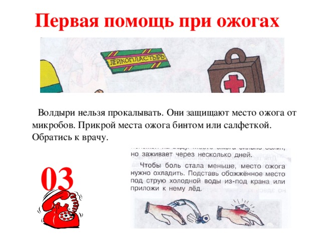 Первая помощь при ожогах  Волдыри нельзя прокалывать. Они защищают место ожога от микробов. Прикрой места ожога бинтом или салфеткой. Обратись к врачу.  03 