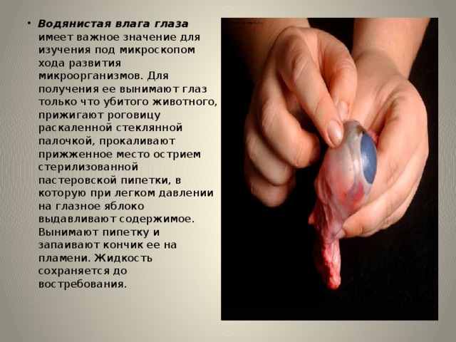 Водянистая влага глаза имеет важное значение для изучения под микроскопом хода развития микроорганизмов. Для получения ее вынимают глаз только что убитого животного, прижигают роговицу раскаленной стеклянной палочкой, прокаливают прижженное место острием стерилизованной пастеровской пипетки, в которую при легком давлении на глазное яблоко выдавливают содержимое. Вынимают пипетку и запаивают кончик ее на пламени. Жидкость сохраняется до востребования. 