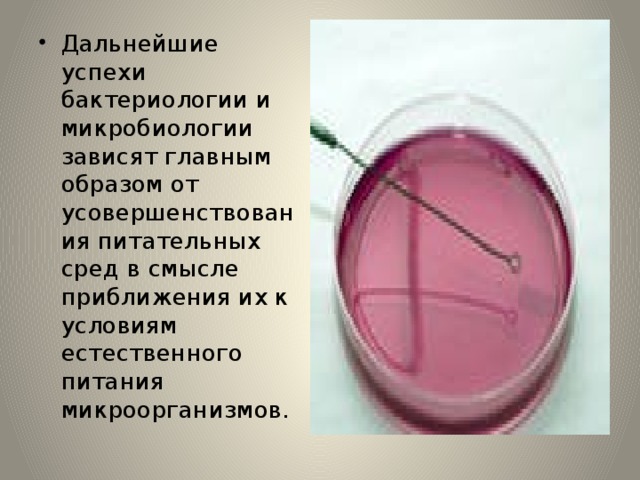 Дальнейшие успехи бактериологии и микробиологии зависят главным образом от усовершенствования питательных сред в смысле приближения их к условиям естественного питания микроорганизмов. 