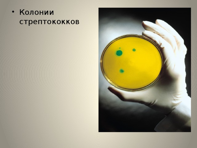 Колонии стрептококков 