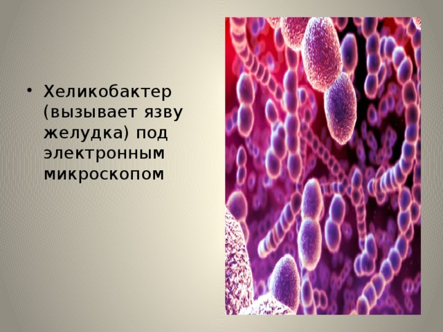 Хеликобактер (вызывает язву желудка) под электронным микроскопом 