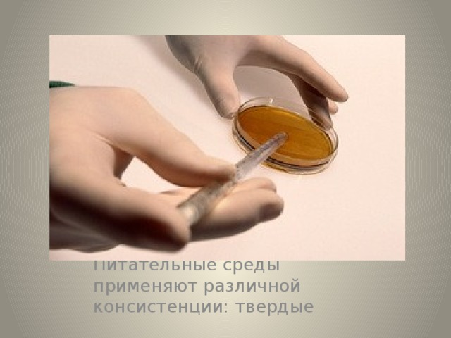 Питательные среды применяют различной консистенции: твердые 
