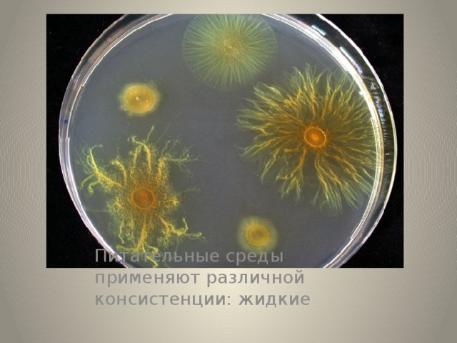 Питательные среды применяют различной консистенции: жидкие 