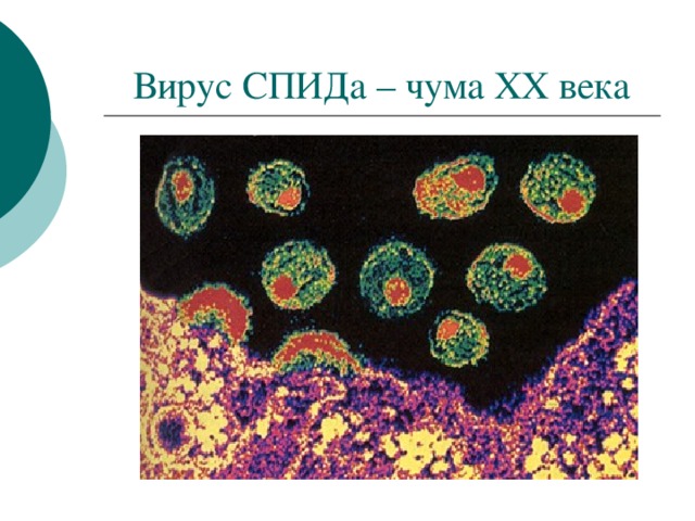 Вирус СПИДа – чума XX века 