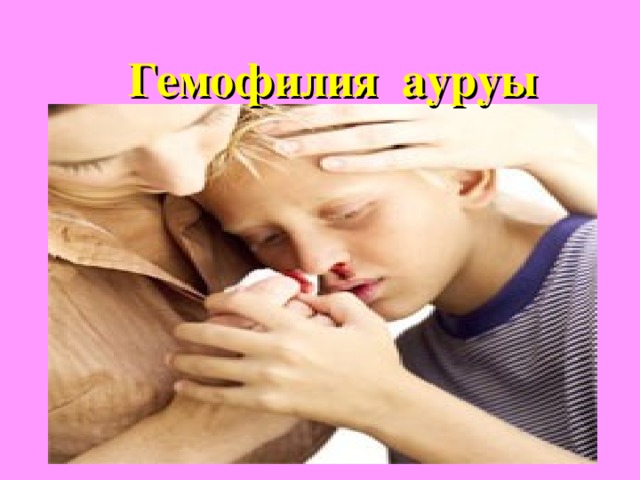 Хромосомалар санының өзгеруінен және олардың құрылымының бұзылуынан пайда болатын аурулар Клайнфельтер синдромы Шерешевский – Тернер  синдромы  Даун синдромы Ақыл – есінің туа біте кем болуы, икемсіз, жүрек – тамыр жүйесінің және ішкі секреция бездерінің қызметтерінің бұзылуы байқалады.    Әйелдердің бойы аласа болып, жыныстық жетілуі баяулап, бедеу болады Жыныс бездері жете дамымайды, ақыл – есі кем, аяғы мен бойы ұзын, басы кішкентай 