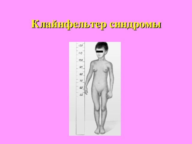  Медициналық генетика  — тұқым қуалайтын аурулар, олардан сақтану, оларды анықтау және емдеу туралы ғылым, генетиканың бір саласы. Бүкіл дүниежүзілік статистика бойынша дүниеге келіп жатқан сәбилердің шамамен 7—8%-ы түрлі тұқым қуалайтын аурулармен ауырады. Сондықтан сол ауруларды жан-жақты зерттеу, олардан алдын ала сақтандыру және емдеу жалпы адам генетикасының, соның ішінде, медициналық генетиканың негізгі проблемасы болып табылады. Генетиканың бұл саласы бойынша зерттелетін келесі маңызды бір мәселе — адамда тұқым қуалайтын өзгерісті қандай факторлардың тудыратынын және адамзатты көптеген ауыр зардаптардан құтқару үшін оларға шара қолданудың жолдарын зерттеу.   Бүгінгі таңда тұқым қуалайтын 1 мыңнан аса  ауру  түрлері бар, соның 400-ден астамы бір ғана ген мутациясының себебінен болады. Жаңа туылған нәрестелердің орта есеппен 5%-ындағы кемтарлық олардың генетикалық материалына тікелей байланысты. Қазіргі уақытта гендік терапия тұқым қуалайтын ауруларға бейім адамдарды, жұқпалы, тағыда басқа ауруларды емдеуде жиі қолданылады. 