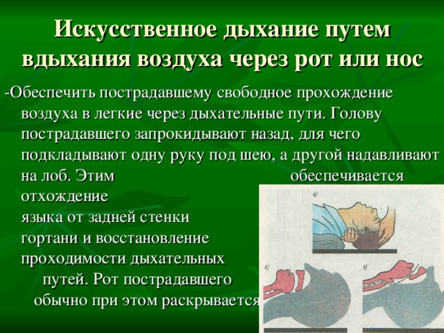Искусственное дыхание путем вдыхания воздуха через рот или нос -Обеспечить пострадавшему свободное прохождение воздуха в легкие через дыхательные пути. Голову пострадавшего запрокидывают назад, для чего подкладывают одну руку под шею, а другой надавливают на лоб. Этим обеспечивается отхождение корня языка от задней стенки гортани и восстановление проходимости дыхательных путей. Рот пострадавшего обычно при этом раскрывается 