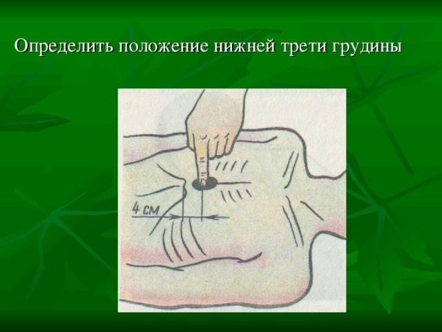Определить положение нижней трети грудины 