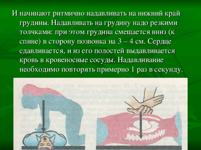И начинают ритмично надавливать на нижний край грудины. Надавливать на грудину надо резкими толчками: при этом грудина смещается вниз (к спине) в сторону позвонка на 3 – 4 см. Сердце сдавливается, и из его полостей выдавливается кровь в кровеносные сосуды. Надавливание необходимо повторять примерно 1 раз в секунду. 