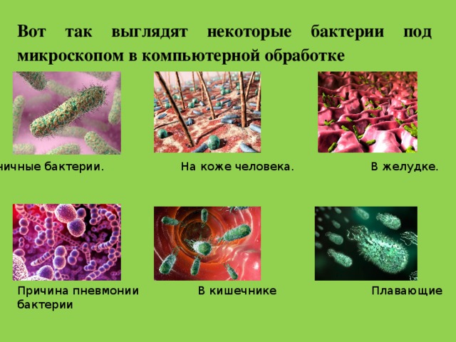 Вот так выглядят некоторые бактерии под микроскопом в компьютерной обработке Ресничные бактерии. На коже человека. В желудке. Причина пневмонии В кишечнике Плавающие бактерии 