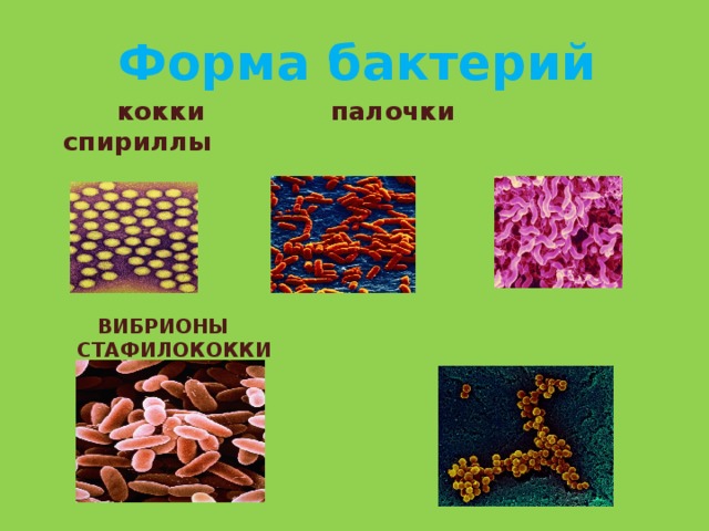 Форма бактерий  кокки палочки спириллы  Вибрионы стафилококки 