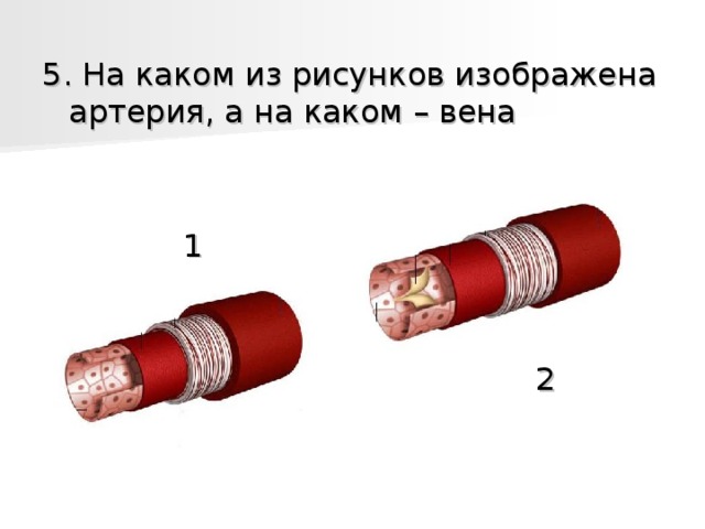 5. На каком из рисунков изображена артерия, а на каком – вена    1         2 
