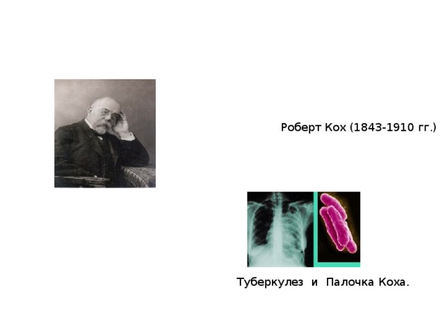 Роберт Кох (1843-1910 гг.) Туберкулез и Палочка Коха. 