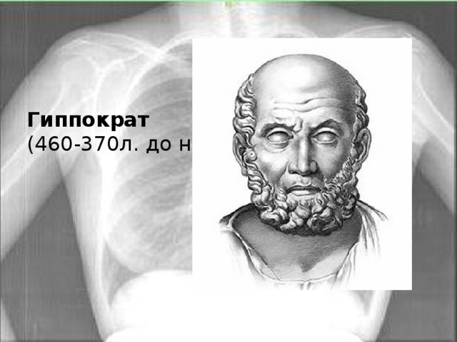 Гиппократ  (460-370л. до н.э.) 