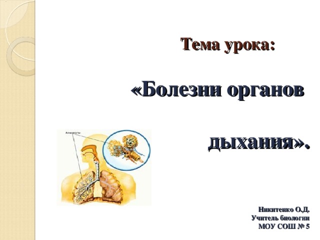   Тема урока:   «Болезни органов    дыхания».    Никитенко О.Д.  Учитель биологии  МОУ СОШ № 5   