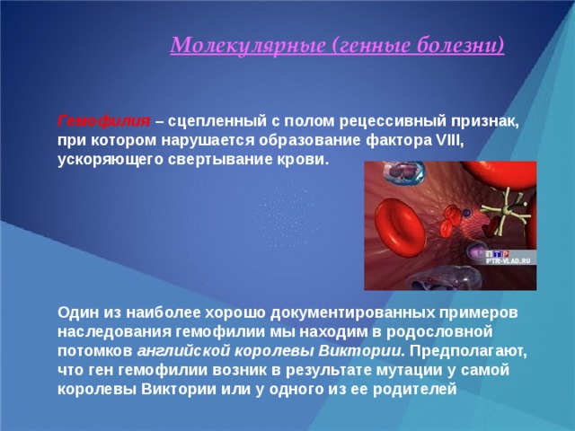  Молекулярные (генные болезни)   Гемофилия – сцепленный с полом рецессивный признак, при котором нарушается образование фактора VIII, ускоряющего свертывание крови.        Один из наиболее хорошо документированных примеров наследования гемофилии мы находим в родословной потомков английской королевы Виктории . Предполагают, что ген гемофилии возник в результате мутации у самой королевы Виктории или у одного из ее родителей 