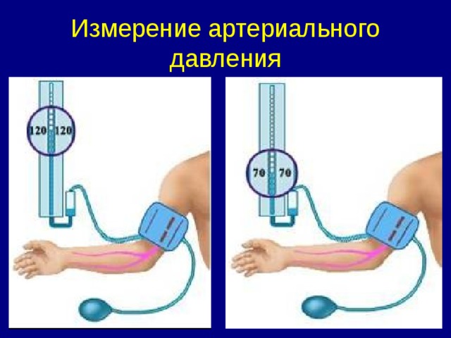 Измерение артериального давления 