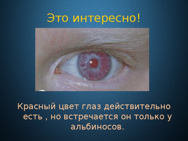 Это интересно! Красный цвет глаз действительно есть , но встречается он только у альбиносов. 