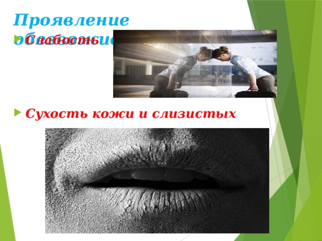 Проявление обезвоживания Слабость     Сухость кожи и слизистых 