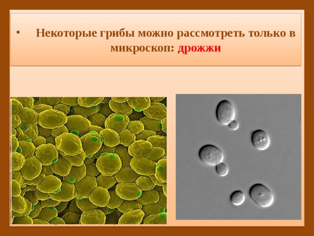 Некоторые грибы можно рассмотреть только в микроскоп: дрожжи 