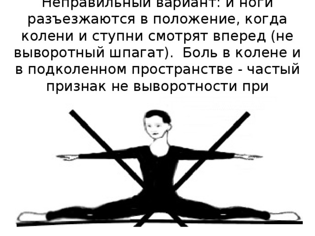 Неправильный вариант: и ноги разъезжаются в положение, когда колени и ступни смотрят вперед (не выворотный шпагат).  Боль в колене и в подколенном пространстве - частый признак не выворотности при растяжке. 