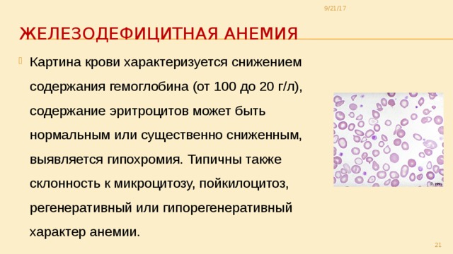 9/21/17 Железодефицитная анемия Картина крови характеризуется снижением содержания гемоглобина (от 100 до 20 г/л), содержание эритроцитов может быть нормальным или существенно сниженным, выявляется гипохромия. Типичны также склонность к микроцитозу, пойкилоцитоз, регенеративный или гипорегенеративный характер анемии.  