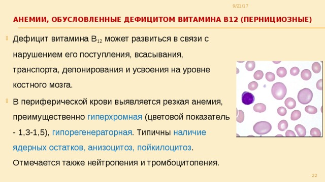 9/21/17 АНЕМИИ, ОБУСЛОВЛЕННЫЕ ДЕФИЦИТОМ ВИТАМИНА В12 (ПЕРНИЦИОЗНЫЕ)   Дефицит витамина В 12  может развиться в связи с нарушением его поступления, всасывания, транспорта, депонирования и усвоения на уровне костного мозга. В периферической крови выявляется резкая анемия, преимущественно гиперхромная (цветовой показатель - 1,3-1,5), гипорегенераторная . Типичны наличие ядерных остатков, анизоцитоз, пойкилоцитоз . Отмечается также нейтропения и тромбоцитопения.  