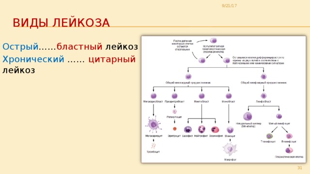 9/21/17 Виды лейкоза Острый …… бластный лейкоз Хронический …… цитарный лейкоз 29 