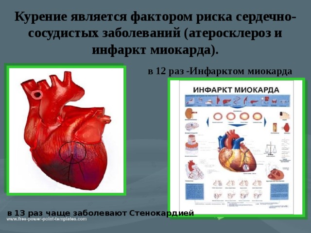   Курение является фактором риска сердечно-сосудистых заболеваний (атеросклероз и инфаркт миокарда). в 12 раз -Инфарктом миокарда в 13 раз чаще заболевают Стенокардией 