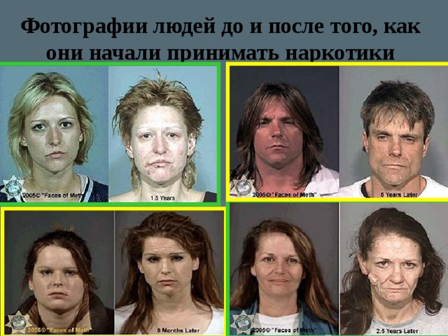 Фотографии людей до и после того, как они начали принимать наркотики 