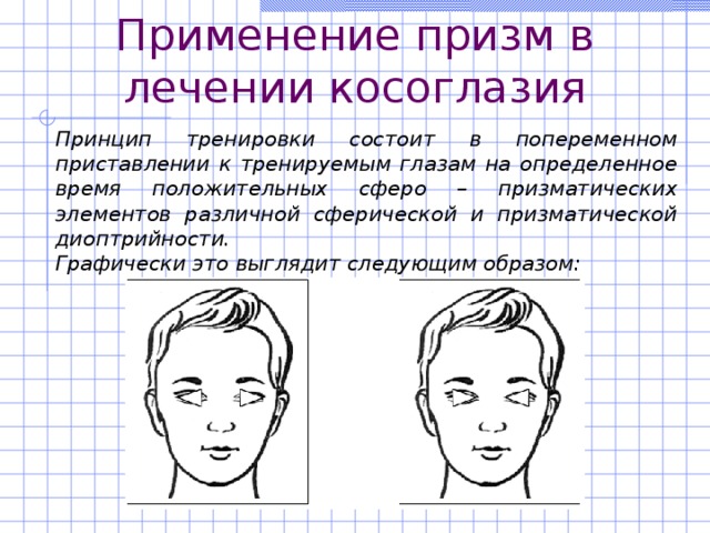 Применение призм в лечении косоглазия Принцип тренировки состоит в попеременном приставлении к тренируемым глазам на определенное время положительных сферо – призматических элементов различной сферической и призматической диоптрийности. Графически это выглядит следующим образом: 