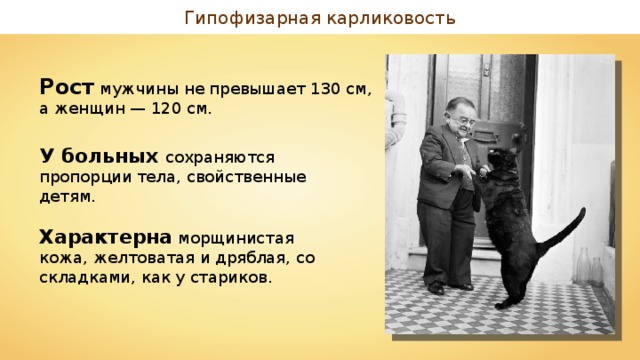 Гипофизарная карликовость Рост мужчины не превышает 130 см, а женщин — 120 см.  У больных сохраняются пропорции тела, свойственные детям. Характерна морщинистая кожа, желтоватая и дряблая, со складками, как у стариков. 