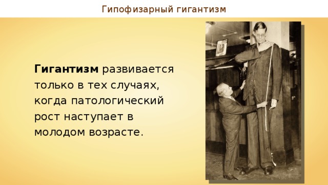 Гипофизарный гигантизм Гигантизм развивается только в тех случаях, когда патологический рост наступает в молодом возрасте. 