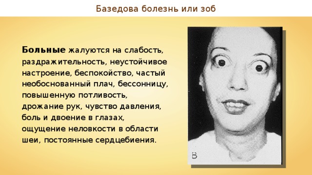 Базедова болезнь или зоб Больные жалуются на слабость, раздражительность, неустойчивое настроение, беспокойство, частый необоснованный плач, бессонницу, повышенную потливость, дрожание рук, чувство давления, боль и двоение в глазах, ощущение неловкости в области шеи, постоянные сердцебиения. 