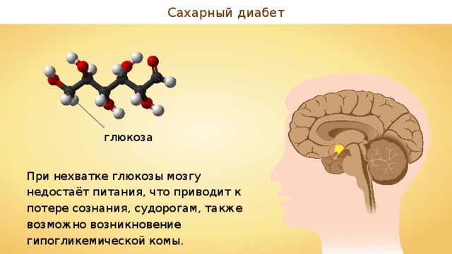 Сахарный диабет глюкоза При нехватке глюкозы мозгу недостаёт питания, что приводит к потере сознания, судорогам, также возможно возникновение гипогликемической комы. 