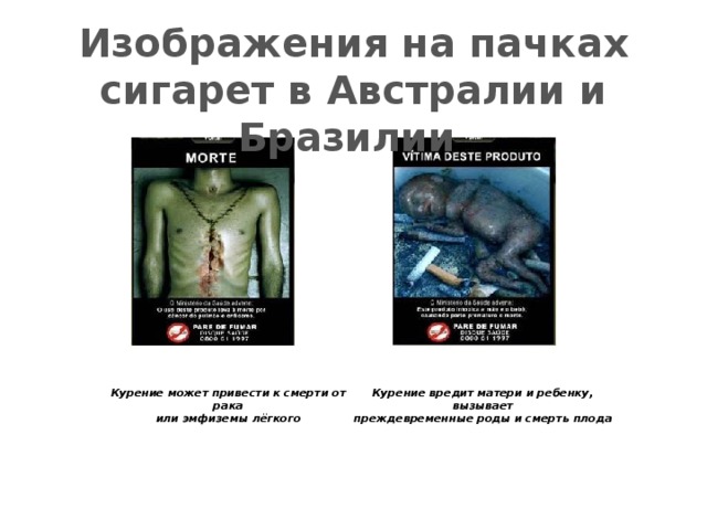 Изображения на пачках сигарет в Австралии и Бразилии Курение может привести к смерти от рака Курение вредит матери и ребенку, вызывает  или эмфиземы лёгкого  преждевременные роды и смерть плода 