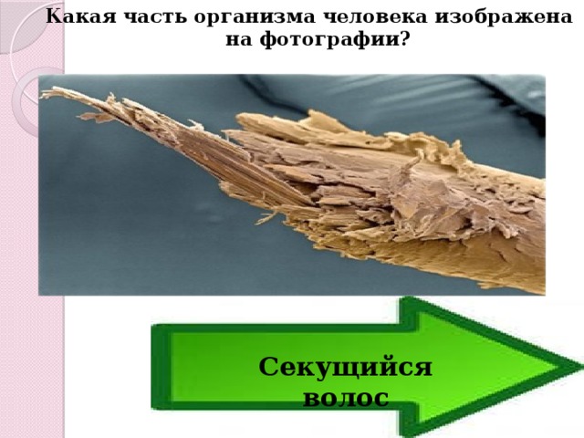 Какая часть организма человека изображена на фотографии? Секущийся волос 