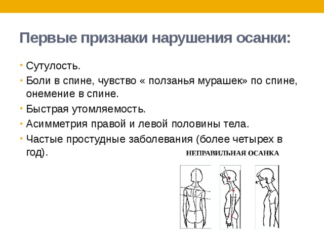 Первые признаки нарушения осанки: Сутулость. Боли в спине, чувство « ползанья мурашек» по спине, онемение в спине. Быстрая утомляемость. Асимметрия правой и левой половины тела. Частые простудные заболевания (более четырех в год). 