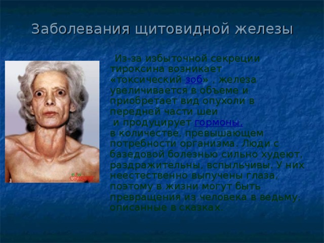 Заболевания щитовидной железы    Из-за избыточной секреции тироксина возникает «токсический   зоб » , железа увеличивается в объеме и приобретает вид опухоли в передней части шеи  и продуцирует  гормоны, в количестве, превышающем потребности организма. Люди с базедовой болезнью сильно худеют, раздражительны, вспыльчивы. У них неестественно выпучены глаза, поэтому в жизни могут быть превращения из человека в ведьму, описанные в сказках. 