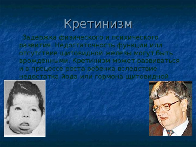 Кретинизм  Задержка физического и психического развития. Недостаточность функции или отсутствие щитовидной железы могут быть врожденными. Кретинизм может развиваться и в процессе роста ребенка вследствие недостатка йода или гормона щитовидной железы. 