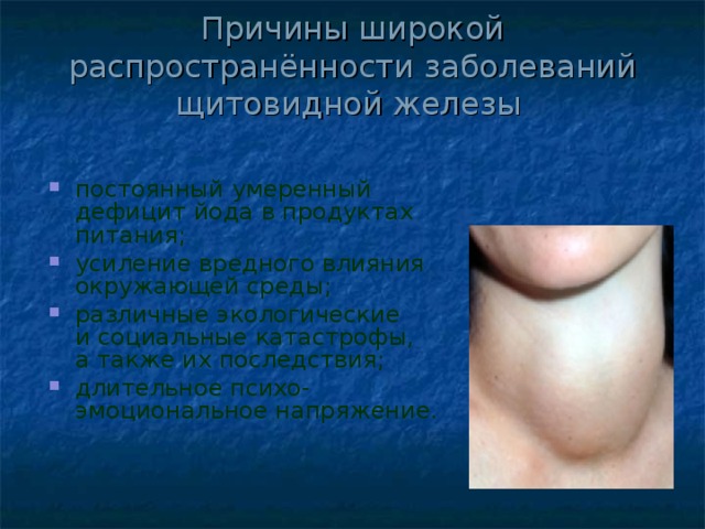 Причины широкой распространённости заболеваний щитовидной железы  постоянный умеренный дефицит йода в продуктах питания; усиление вредного влияния окружающей среды; различные экологические и социальные катастрофы, а также их последствия; длительное психо-эмоциональное напряжение. 