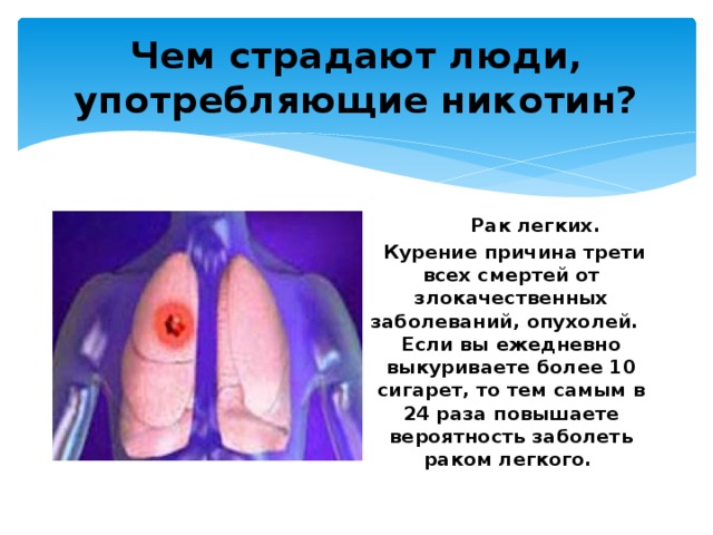 Чем страдают люди, употребляющие никотин?  Рак легких.  Курение причина трети всех смертей от злокачественных заболеваний, опухолей. Если вы ежедневно выкуриваете более 10 сигарет, то тем самым в 24 раза повышаете вероятность заболеть раком легкого. 