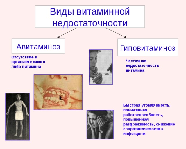 Виды витаминной недостаточности Авитаминоз Гиповитаминоз Отсутствие в организме какого-либо витамина Частичная недостаточность витамина Быстрая утомляемость, пониженная работоспособность, повышенная раздражимость, снижение сопротивляемости к инфекциям 